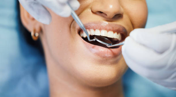 Best Broken or Chipped Tooth Repair in Tarboro, NC